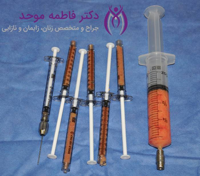 مراقبت های بعد از تزریق چربی به واژن